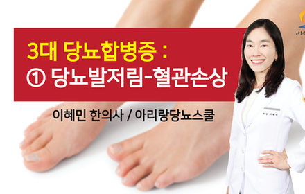 [당뇨스쿨] 당뇨합병증  ① 혈관손상으로 인한 당뇨발저림