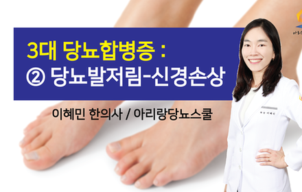 [당뇨스쿨] 당뇨합병증 ② 당뇨발저림-신경손상 