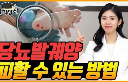 [당뇨스쿨] 당뇨발 궤양, 이렇게 예방하세요!