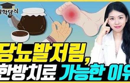 [당뇨스쿨] 당뇨발저림, 한약 치료는 어떻게 할까?