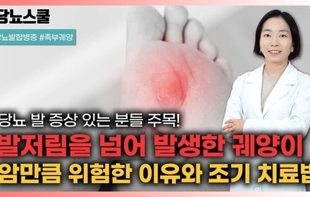 [당뇨스쿨] 암만큼 위험한 당뇨병성 족부궤양과 절단, 반드시 치료하셔야 합니다