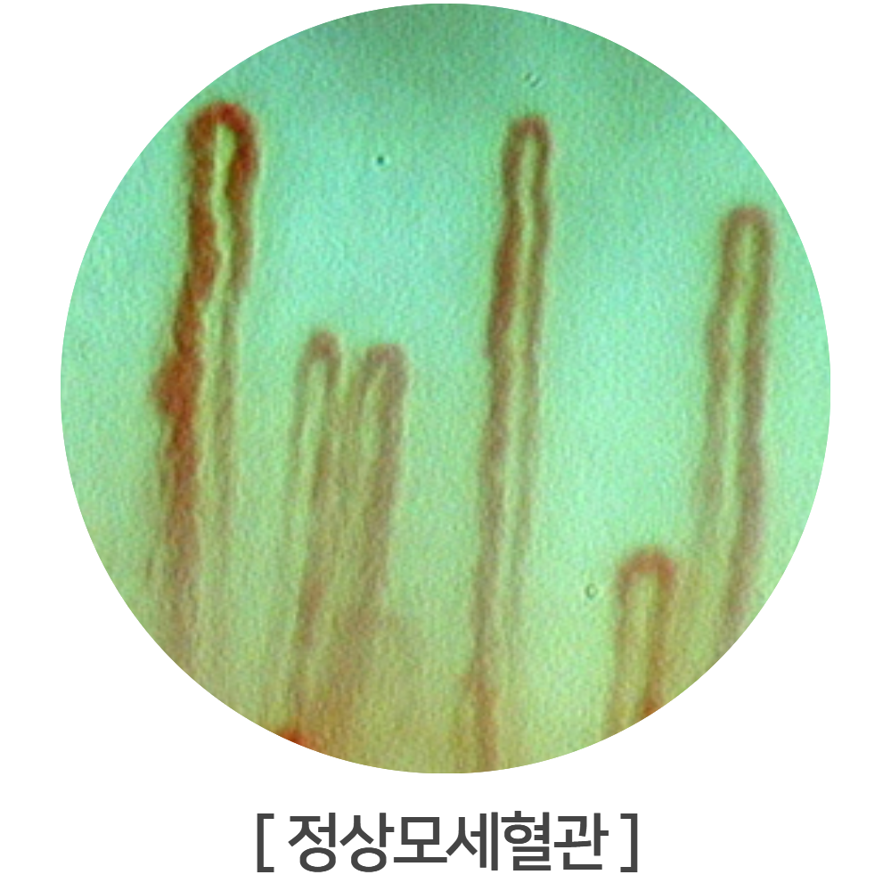 이미지명