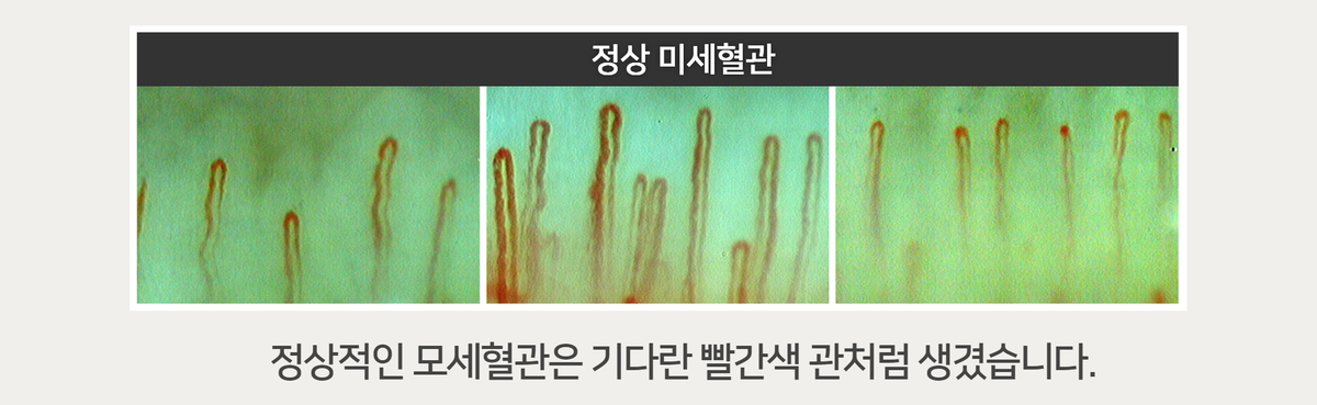 이미지명