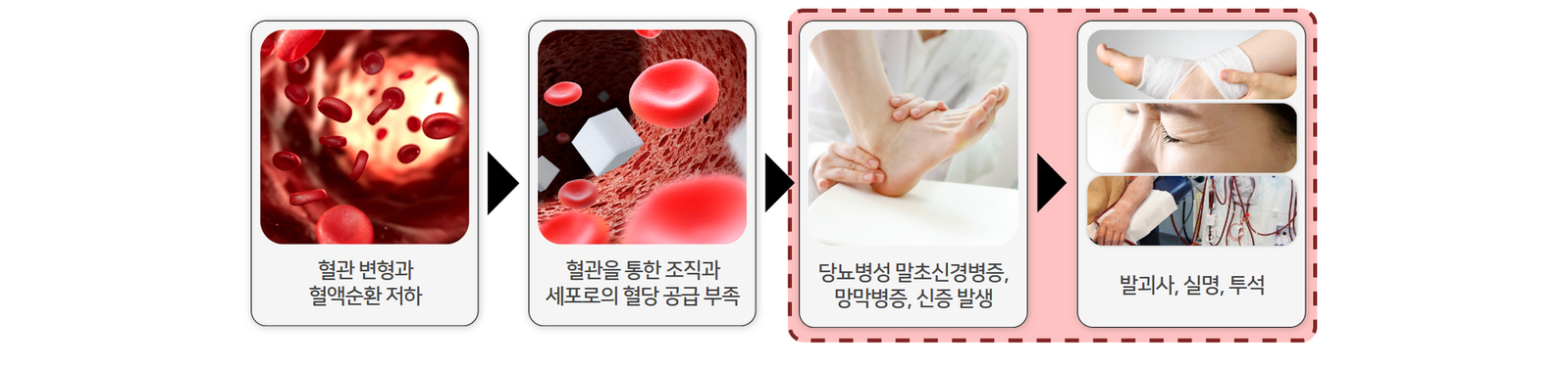 이미지명