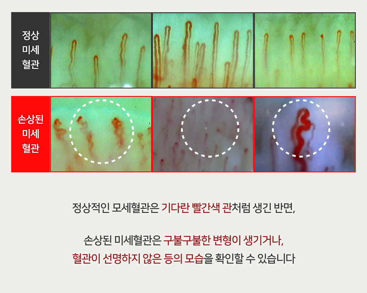 이미지명