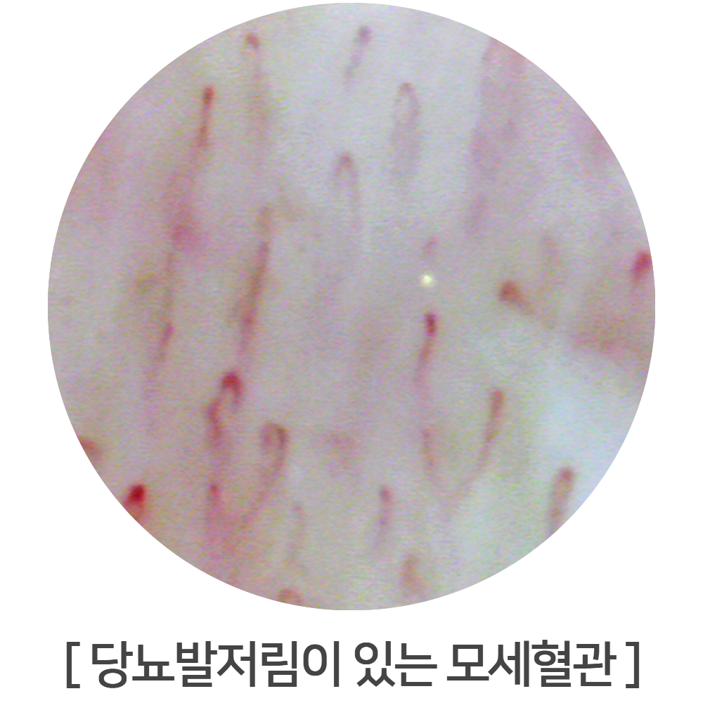 이미지명