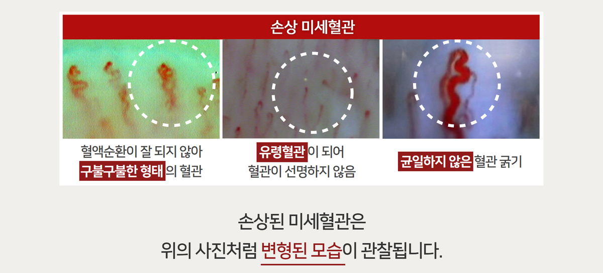 이미지명